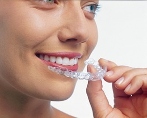 Invisalign_Trio1